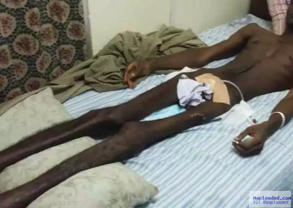 Man Left Paralyzed For Life After Being Shot By A Policeman (See Photos)